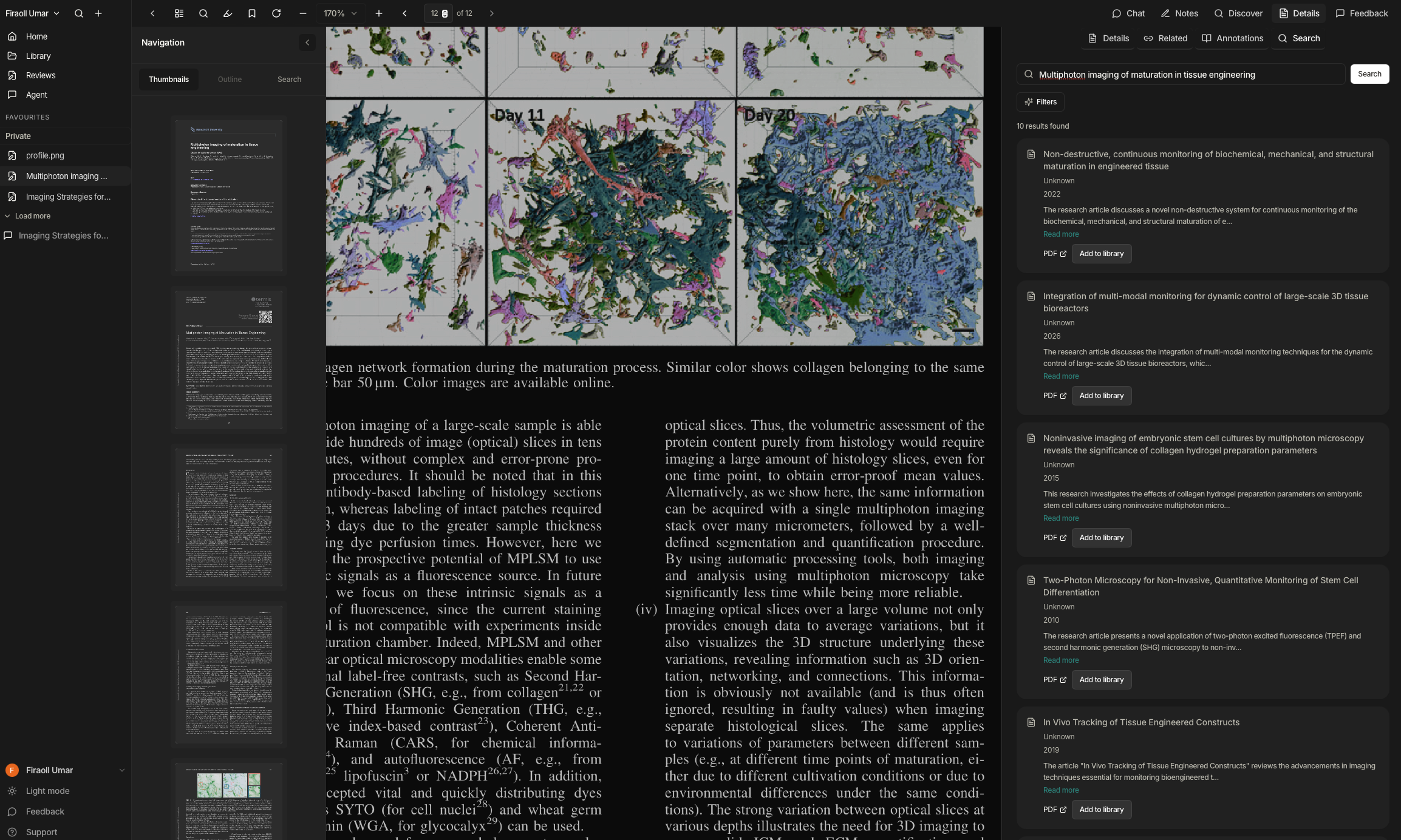 Serenoty interface in dark mode